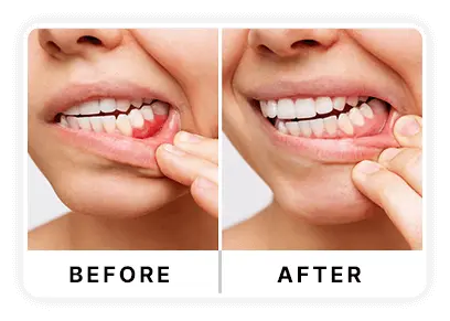 dentavive Supplement Bottle